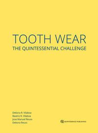 Tooth Wear