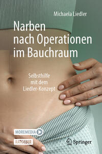 Narben nach Operationen im Bauchraum
