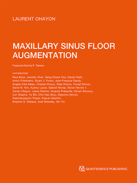 Maxillary Sinus Floor Augmentation