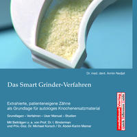 Das Smart Grinder-Verfahren